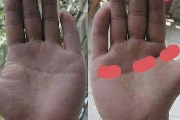 女人断掌真的会二婚吗_断掌的女人会有几个孩子