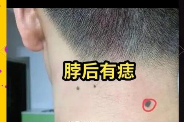 苦情痣头婚必离婚 苦情痣预示头婚必离婚真相揭秘与化解方法 苦情痣头婚必离婚 苦情痣预示头婚必离婚真相揭秘与化解方法