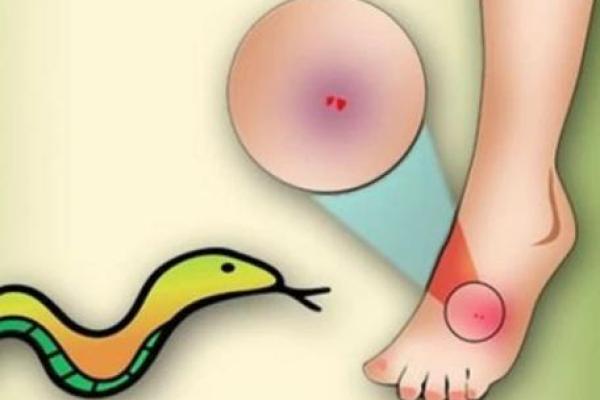 梦到被蛇咬是什么征兆 女性