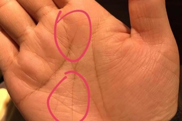 女人胳膊上的二婚线_女人二婚线最明显的征兆 女人胳膊上的二婚线_女人二婚线最明显的征兆