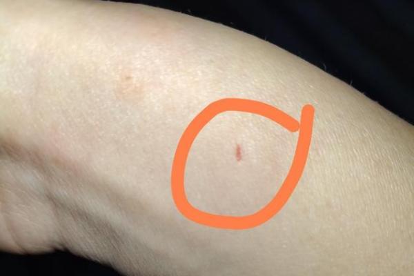 梦到被猫咬是什么征兆 男性