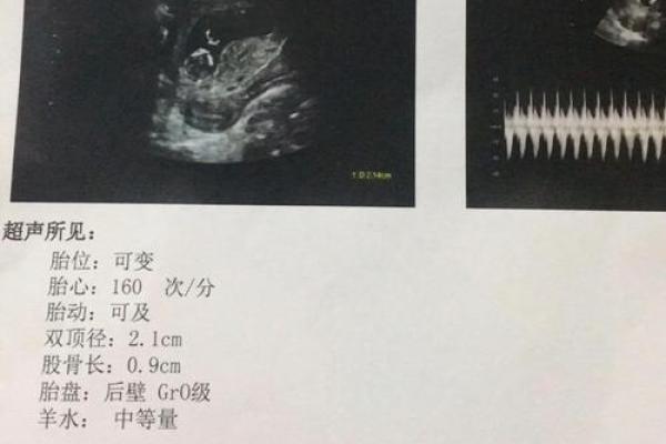 老公做梦梦到我生了个男孩