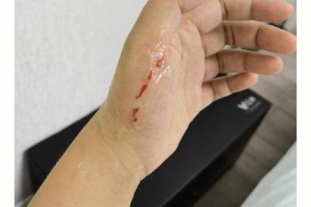 女人梦到被猫抓伤手